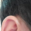 오티콘보청기 고양덕양점 이미지