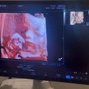 다채움(주) | 실감 나지 않는 임산부의 중기 기록 (18주-27주)