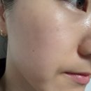 광주 북구 골드 미백 테라피 피부관리 맞춤케어 끌림 뷰티앤바디