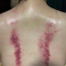 문래동피부관리 사운드바디사운드스킨 골드링 더블임팩트관리 후기