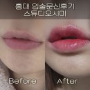 스튜디오시미 | 입술문신후기 틴트립 마곡 스튜디오시미 (통증, 관리, 부작용, 꿀팁)