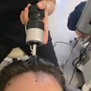 풍무동두피관리 셀비오 두피관리프로그램 리얼후기