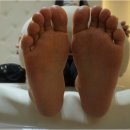 손톱쟁이,발톱쟁이 | 부평발각질 관리 소문난 곳 발톱쟁이