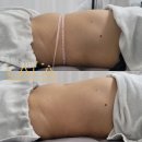 &#34;나만 몰랐어?&#34; 크레이지 015 리얼 후기! 피부&amp;바디 변화 공개