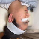 대전 문제성 피부관리 남성피부 오드스킨에서 받은 후기