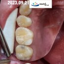 태양치과기공소 이미지