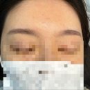 눈썹예쁘니 | 시흥정왕동 반영구 오래된 붉은눈썹 커버후기