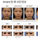얼굴선성형외과의원 이미지