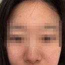 맑은피부린스킨케어화장품 | 인천 강화도 피부관리샵, '더맑은스킨 강화점' 에스테틱 맛집으로 추천해요