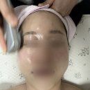 샤이니뷰티테라피 | 대전중구피부관리 리턴뷰티｜중요한 약속 전날 받는 샤이니펌킨필