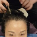 건대 두피크리닉 건선 두피업계 최초항상화관리 닥터모락 건대점