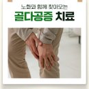 골다공증 원인 증세 검사 수치 낫는법 이미지