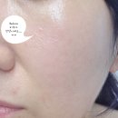 필플러스 | 대명동 피부관리 라플러스에스떼 아쿠아필+물방울관리 받고 온 후기 ✨