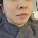 융강빌딩 | 김해 여드름압출 잘하는곳 김해 삼계동 피부관리 주말 피부관리 가능 포포에스테틱