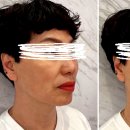 유투성형외과의원 이미지