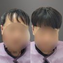 리썸위그 이미지