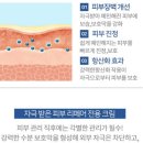 라라스킨 이미지