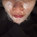 더 페이즈 | 대구쿨페이즈 600샷 후기 피부 탄력 리프팅 전후 비교