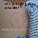 장형석한의원 이미지