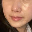 미엘르의원 이미지