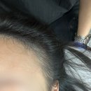 아름헤어라인 - 성남시 수정구 | 아름헤어라인