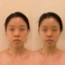 더조각테라피 네이버블로그