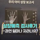이지치과의원 | [내돈내산 리뷰]우리아이 성장예측 검사후기