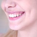 뉴욕연세치과의원 이미지