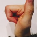 서일교정형외과 이미지