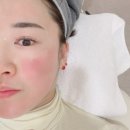 베이스피부과의원 | 덕천 올리브피부과 쿼드세이 모공축소 흉터치료 리프팅 내돈내산 솔직후기