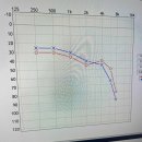 시그니아독일보청기 동작센터 | 동작구보청기 필요할 때 딱! 시그니아 독일보청기 동작센터 후기♡