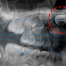 범어스카이치과교정과치과의원 이미지