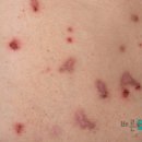 바른숨한의원 이미지