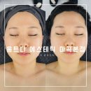명품LMD | 마곡역 고급 에스테틱 <움트다 에스테틱 마곡본점> 맞춤조각 하이푸 윤곽관리 찐만족 후기