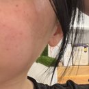 고은수예커텐전문점 | 고척동 에스테틱 고운피부통증케어 어깨통증 독소케어 관리 충격후기