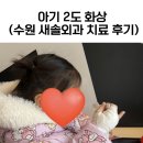 수원-1487 | 용인맘 아기 2도 화상 치료 후기 : 수원 새솔외과 주차 팁 &amp; 37개월 경과 공유