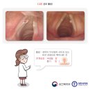 쉼 이미지