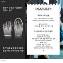 탈라리아 이미지