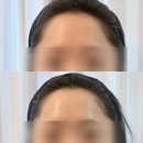 교육센터교육동 2층 | 의정부체형관리 가꾸는동안&amp;숲칼프 의정부교육센터 윤곽리프팅 관리 후기