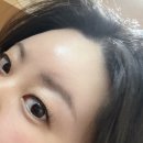 대방마을회관 | 영등포여드름관리, 피부진단 후 1:1 맞춤 해움에스테틱 에서 ldm물방울리프팅 &amp; mts수분관리 후기!