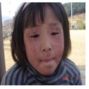 아토피 이렇게 하면 낫는다 이미지