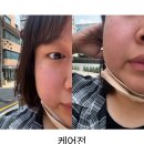 🧴ioma 학동점 체험단 경험기