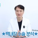 첫눈애