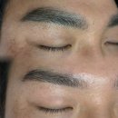 수정샵화정 | 일산 화정 문썹 오래된 어두운 눈썹문신 제거 1회 변화 후기