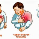 가슴통증 원인 (왼쪽,오른쪽,가운데 흉통) 이미지