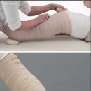 유방암으로 팔쪽 림프절 제거로 인한 부종 증상을 치료하거나 관리 할 수 있는 방법 이미지