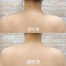 브레인짐 | [상무지구에스테틱]얼굴라인 달라지는 휠로스인약손 브레인테라피 솔직 후기