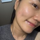 신풍역6번 출구 앞 | 영등포피부관리 신풍역 해움에스테틱 물방울리프팅 보습탄력 충전