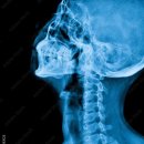 무척바른한의원 이미지