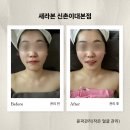 [ 서울 / 이대역] 작은 얼굴관리 새라본 신촌이대본점 후기